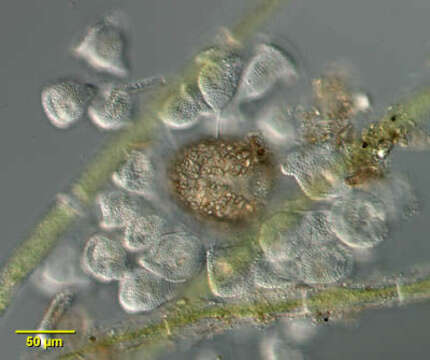 Image of Pseudovorticella monilata