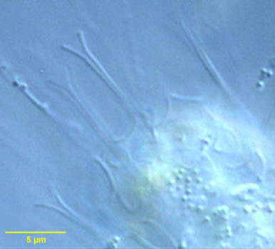 Image of <i>Raphidocystis tubifera</i>