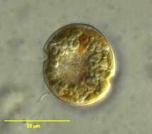 Image of dinoflagellates