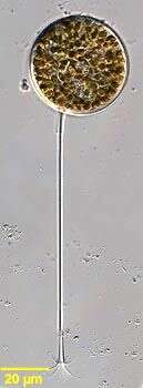 Image of unclassified Dinophyceae