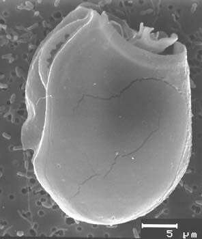 Image of dinoflagellates