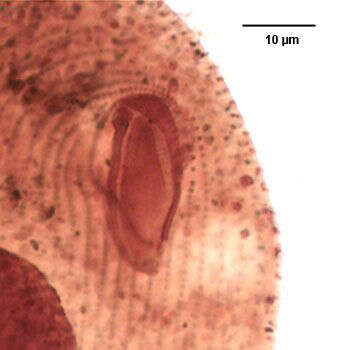 Image of Glaucoma frontata (Stokes 1886) Kahl 1931