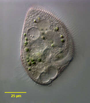 Image de Blepharisma lateritium (Ehrenberg 1831) Stein 1859