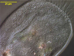 Image of Euplotes eurystomus