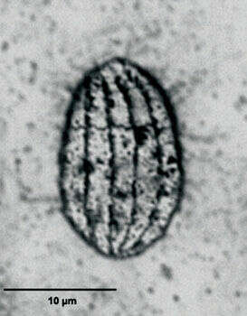 Image of Cyclidium glaucoma