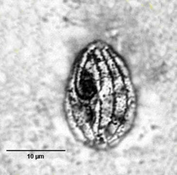 Image of Cyclidium glaucoma