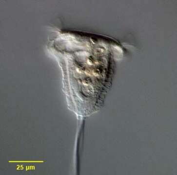 Image of Pseudovorticella Foissner & Schiffmann 1975