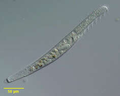 Image of Spirostomum teres