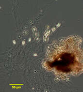 Sivun Epipyxis ramosa (Lauterborn) Hilliard & Asmund 1963 kuva