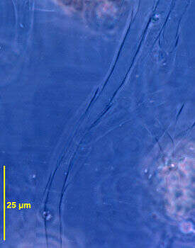 Sivun Epipyxis ramosa (Lauterborn) Hilliard & Asmund 1963 kuva