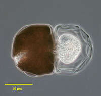 صورة Arcella gibbosa