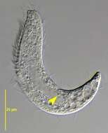 Image of Blepharisma hyalinum