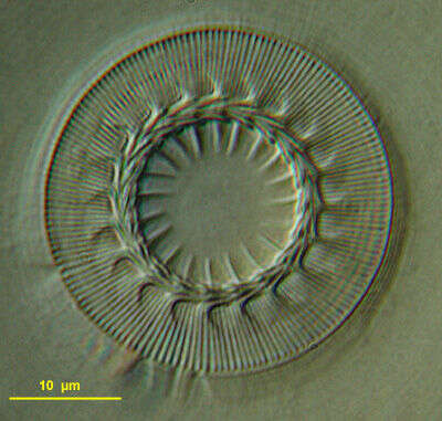 Image of <i>Trichodina domerguei</i> ssp. <i>megamicronucleata</i>