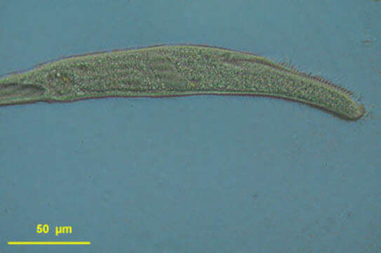 Слика од Spirostomum caudatum