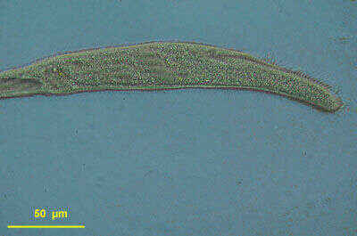 Слика од Spirostomum caudatum