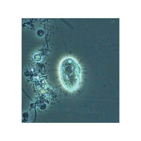 Image of Cyclidium glaucoma