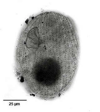 Image of Sphenostomella vernalis (Dragesco & Groliere 1969) Jankowski 1980