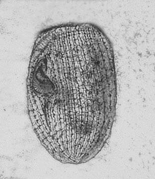 Image of Sphenostomella vernalis (Dragesco & Groliere 1969) Jankowski 1980