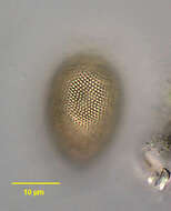 Image of Trachelomonas reticulata
