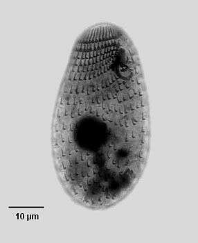 Imagem de Dexiotricha granulosa (Kent 1881) Foissner, Berger & Kohmann 1994