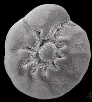 Ammonia parkinsoniana (d'Orbigny 1839) resmi