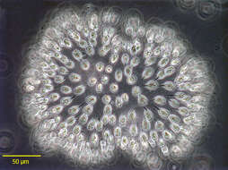 Image of Uroglena volvox