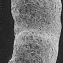 Image of Pseudowebbinella goesi (Höglund 1947)
