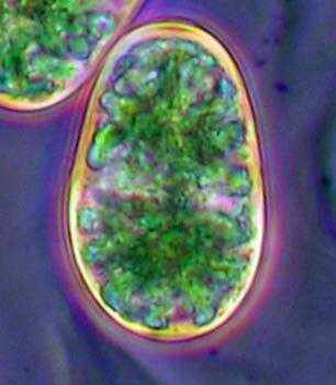 Image of glaucophytes