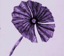 Image of Umbellosphaera irregularis Paasche 1955