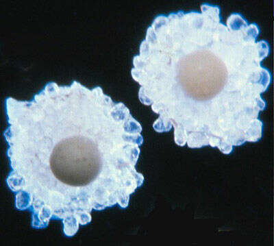 صورة Rhabdammina triangularis (Earland 1933)