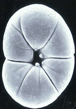 Image of Rotaliella chasteri (Heron-Allen & Earland 1913)