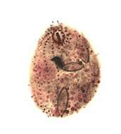 Image of Platyophrya vorax