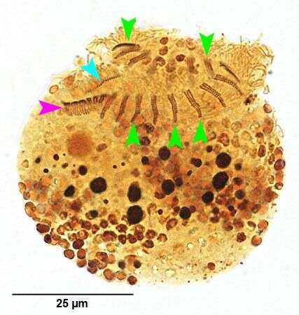 Image of jumping oligotrich