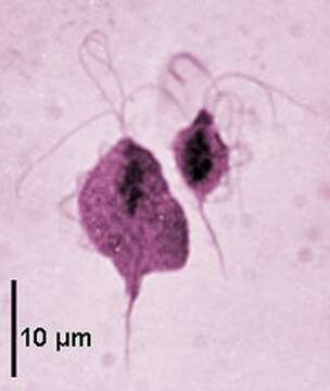 Image of Trichomonas Donné