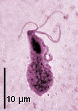 Image of Trichomonas Donné