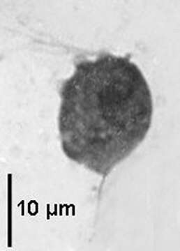 Image of Trichomonas Donné