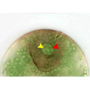 Image of Holophrya ovum Ehrenberg 1831