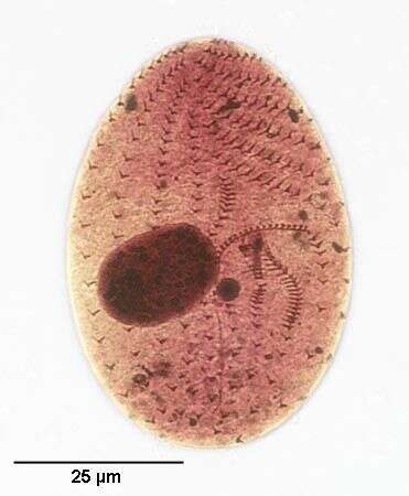 Слика од Colpodidium caudatum
