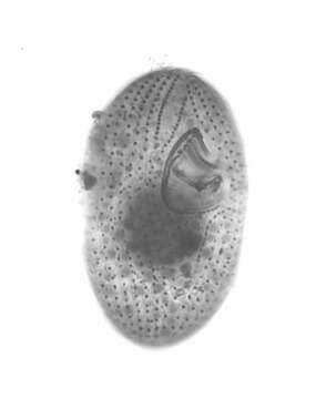 Image of Sphenostomella vernalis (Dragesco & Groliere 1969) Jankowski 1980