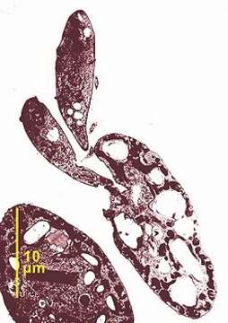 صورة Colpodella perforans (Hollande 1938) Patterson & Zöllfel 1991