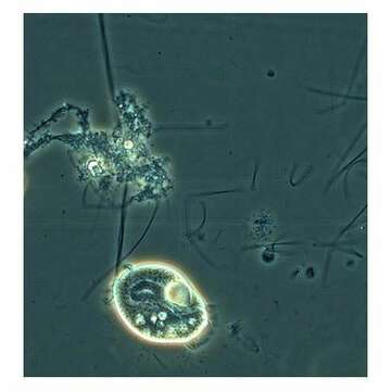 Image de Telotrochidium Kent 1881