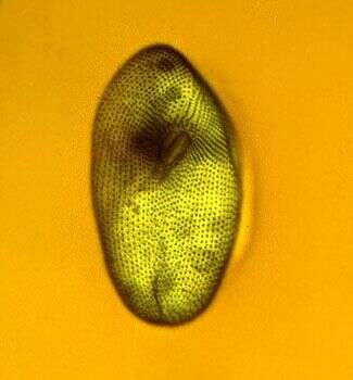 صورة Paramecium putrinum