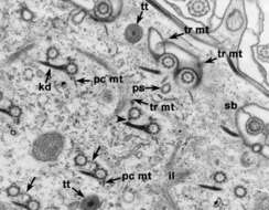 Image of Paramecium multimicronucleatum