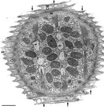 Image of Vorticella convallaria