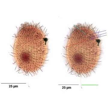 Dexiotricha granulosa (Kent 1881) Foissner, Berger & Kohmann 1994 resmi