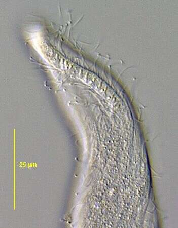 Image de Arcuospathidium Foissner 1984