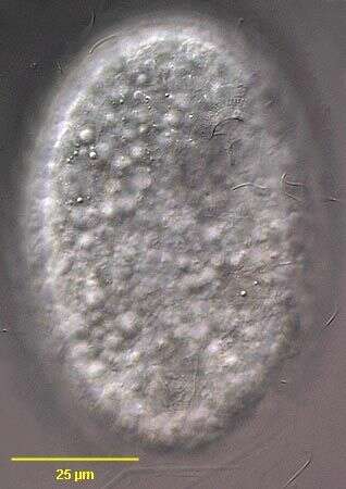 Image of Parafurgasonia sorex (Penard 1922) Foissner & Adam 1981