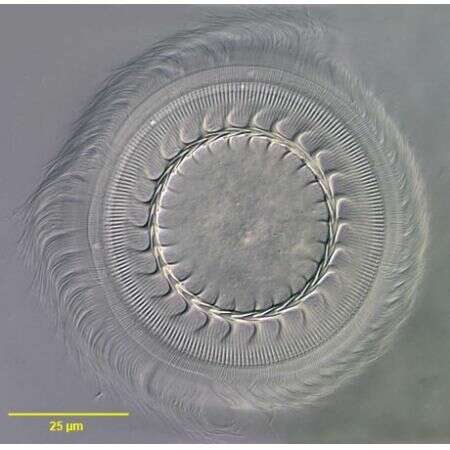 Sivun Trichodina pediculus kuva