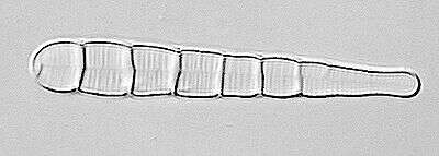 Meridion circulare (Greville) C. Agardh 1831 resmi