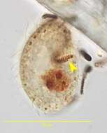 Image of Colpoda aspera